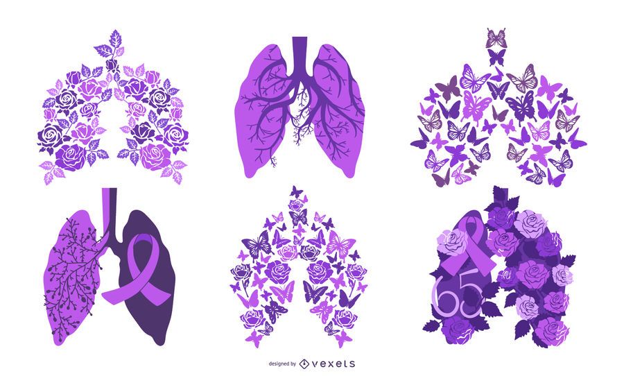 cystic fibrosis